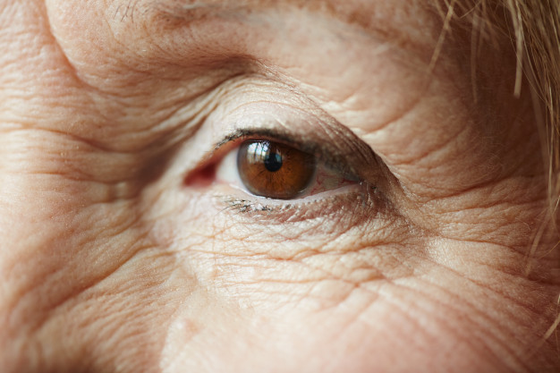 prevent-elderly-wrinkle
